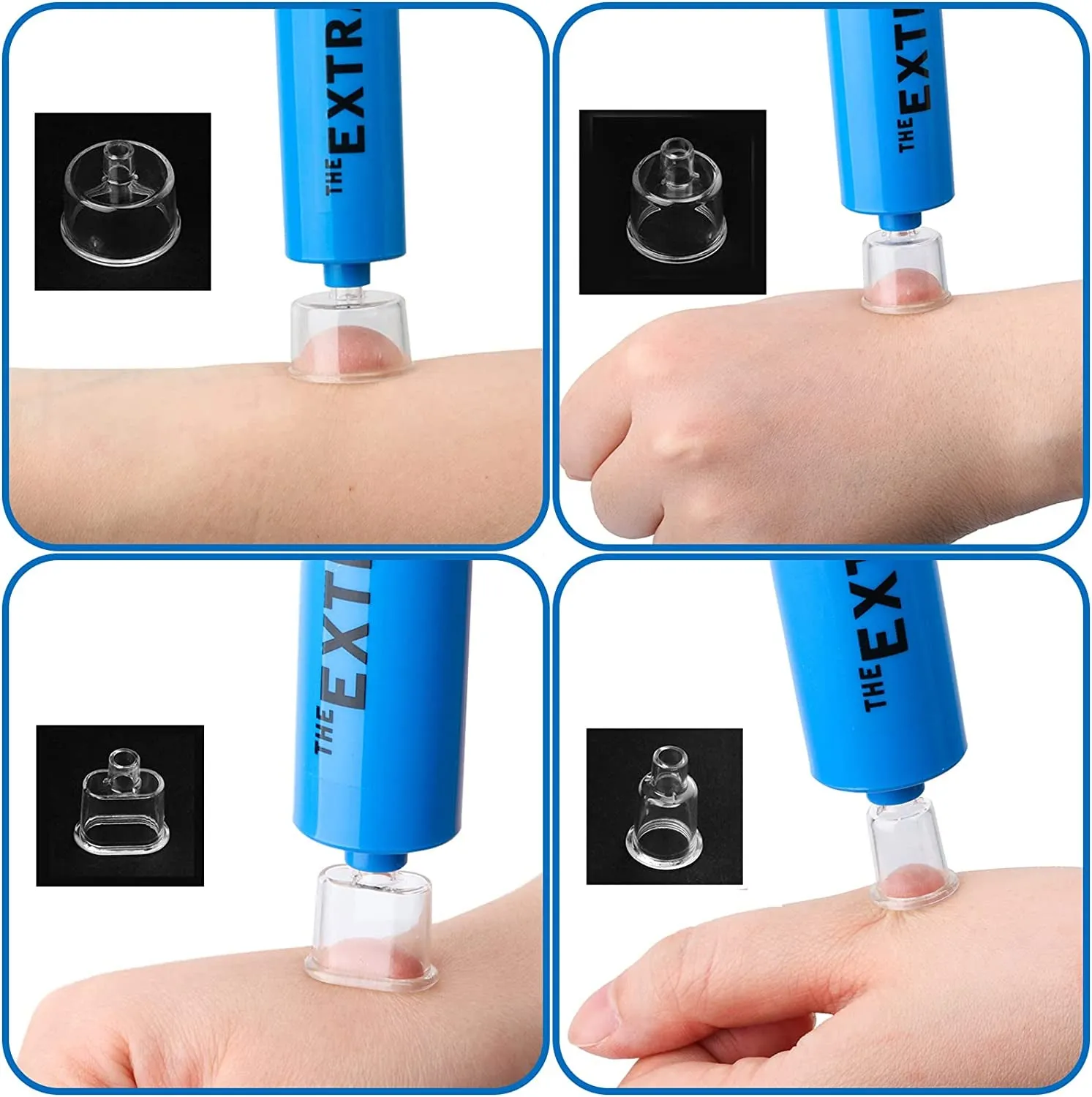 Backpacking Bite Minimalistic Snake Pump, Face Extractor Hiking, Venom Guaranteed security CPR for Kit, Includes Aid Bee Sting Kit, Aid Sting Camping. Emergency Supplies, First Bonus Shield (Blue) and Bite First Suction and