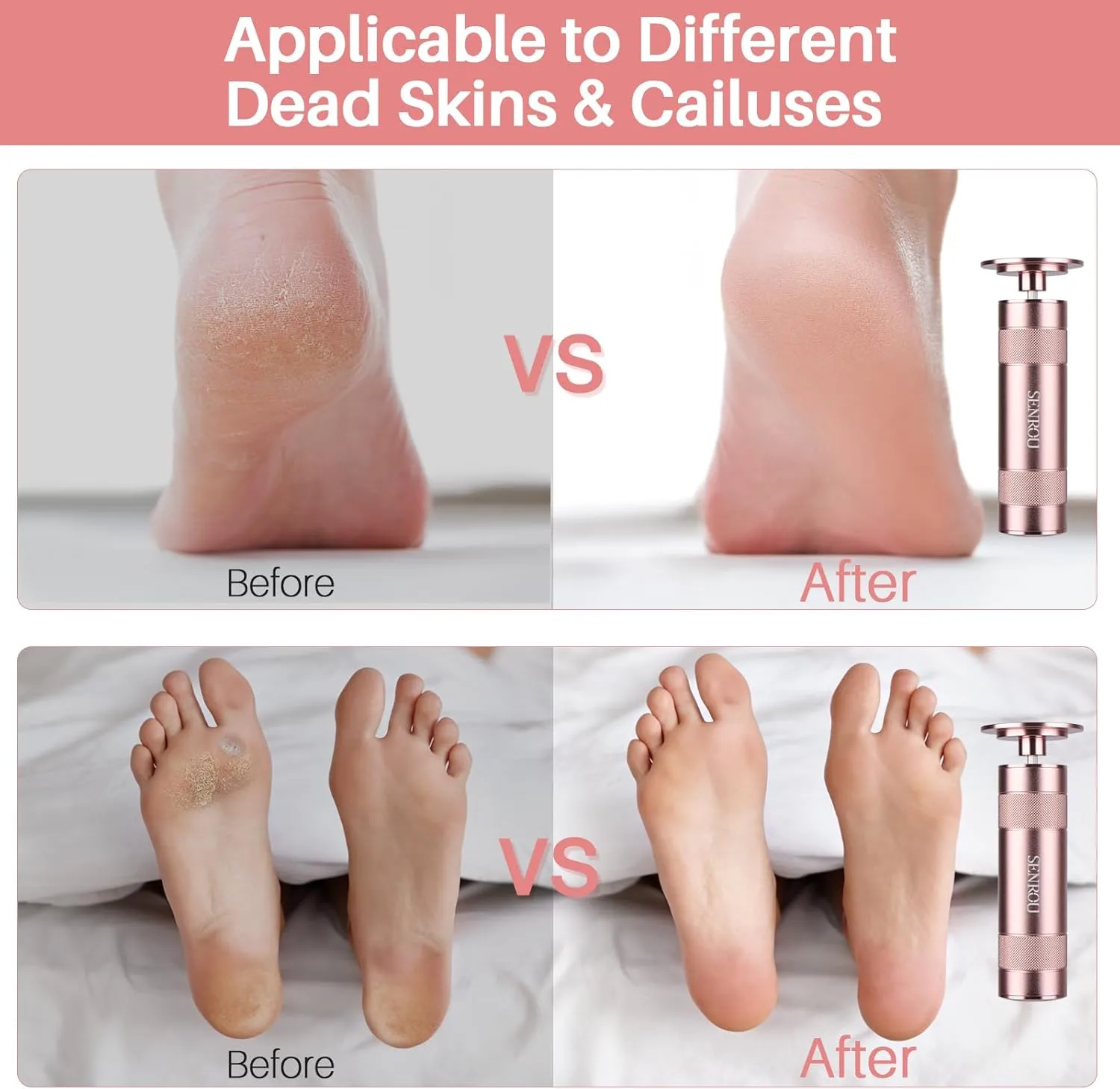 Electric Foot Callus Remover,2-in-1 Foot Filer/Nail Filer, Pedicure Kit Foot Scrubber Deadskin Callus Remover, Foot Care Kit Pedicure Tools for Dead Skin Callus Hardskin Dry Cracks-Champagne Gold