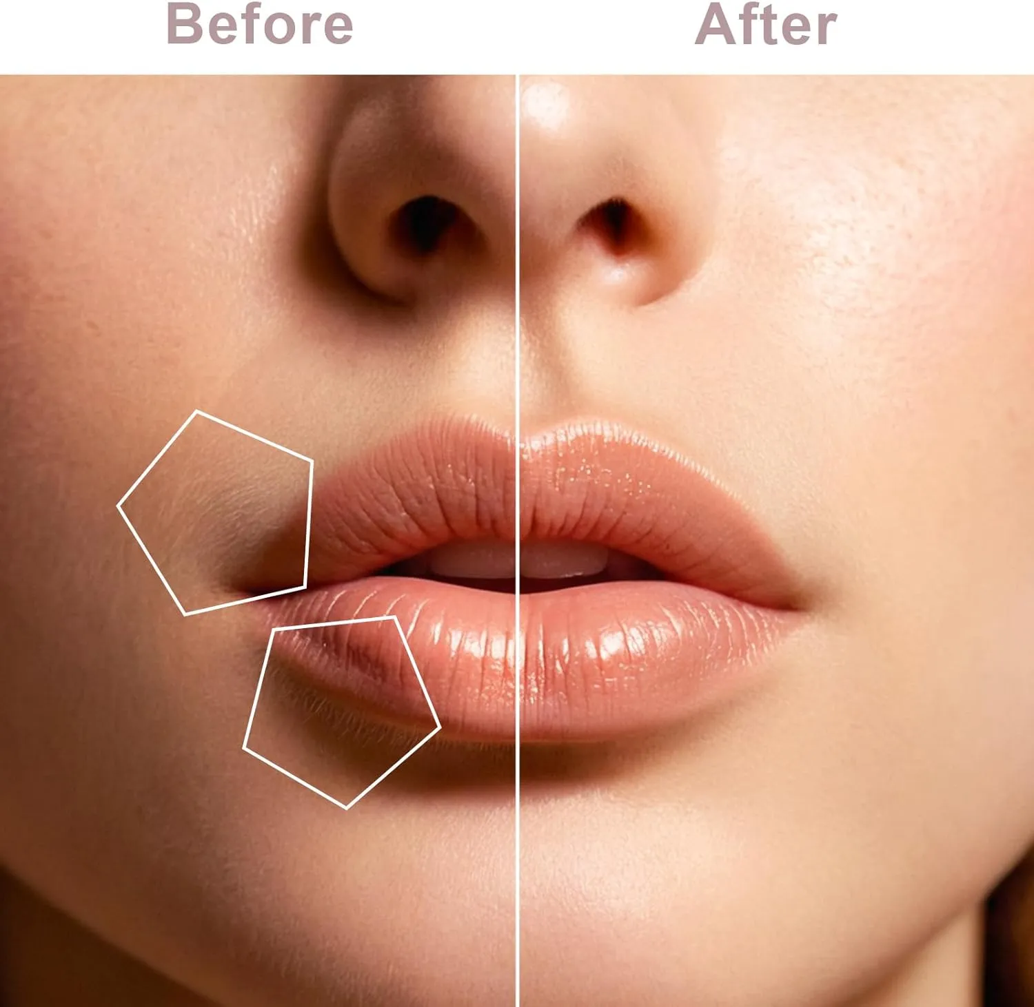 Facial Hair Removal for Women, Painless Hair Removal Device, Portable Facial Hair Remover for Face with USB Rechargeable