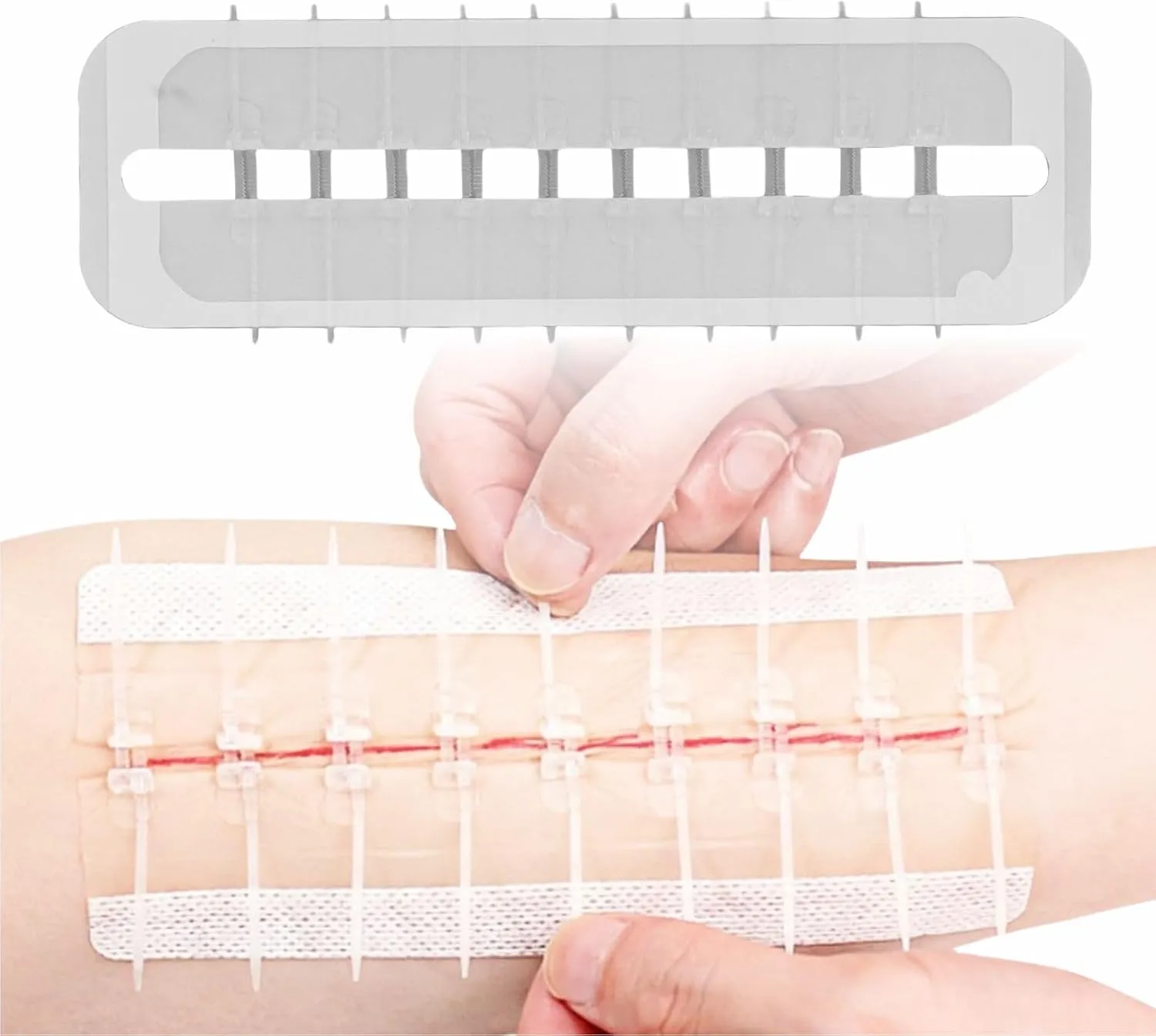Mediss Emergency Wound Closures Band-Aid Adhesive Bandages, Zip Stitch Stickers Device After Caesarean Birth, Injury, Survival (1 Pcs x Individually Wrapped)